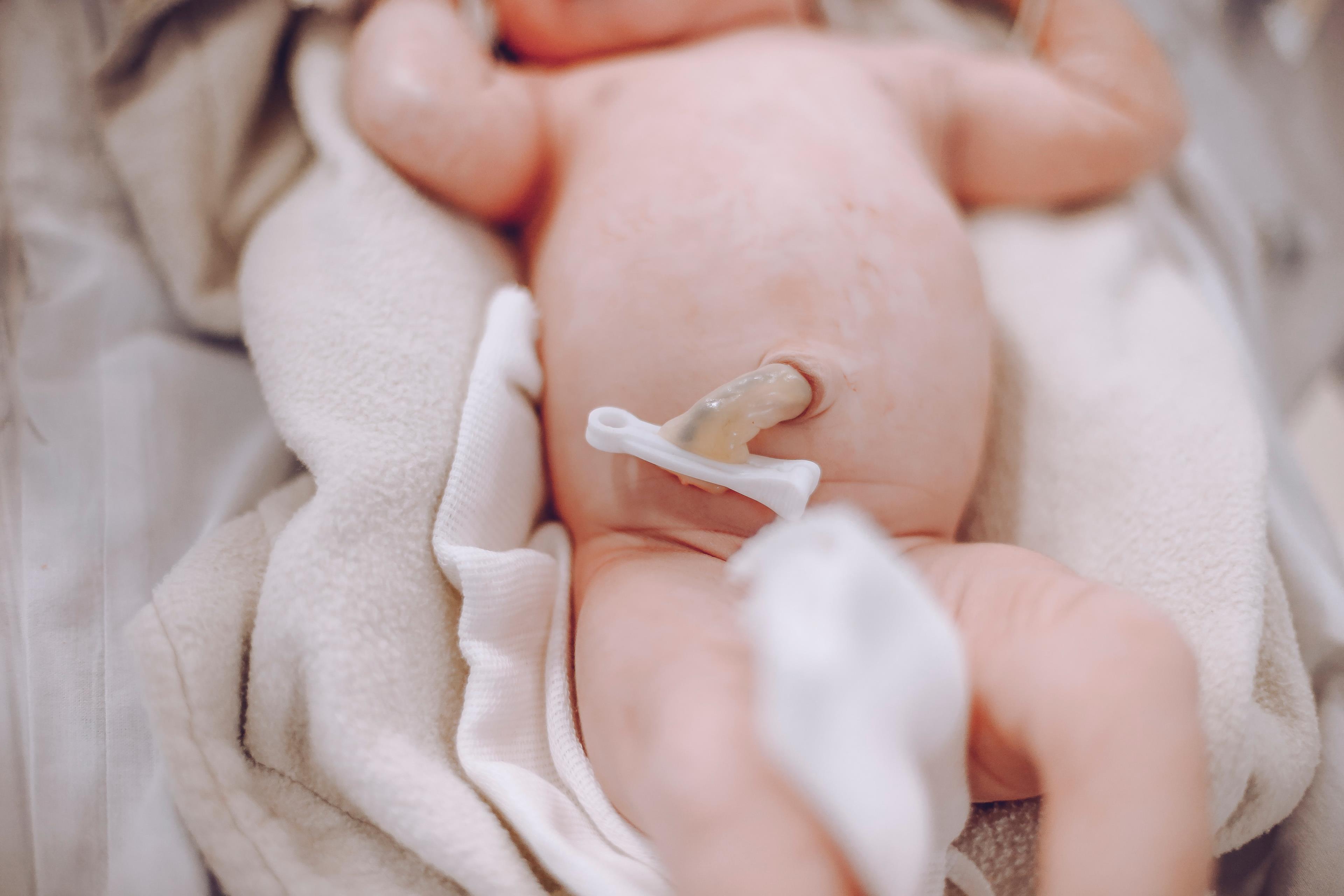 Cordone ombelicale neonato